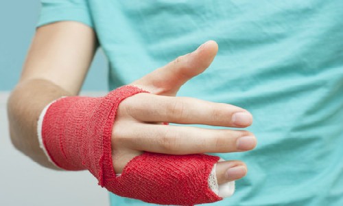 Bone Injuries from Auto Accidents Require a Tough Bone Fracture Lawyer - Testa Law Group
